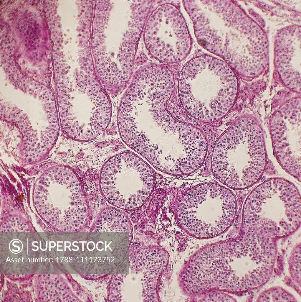 Histological slide of human testis seen under a microscope, at x100