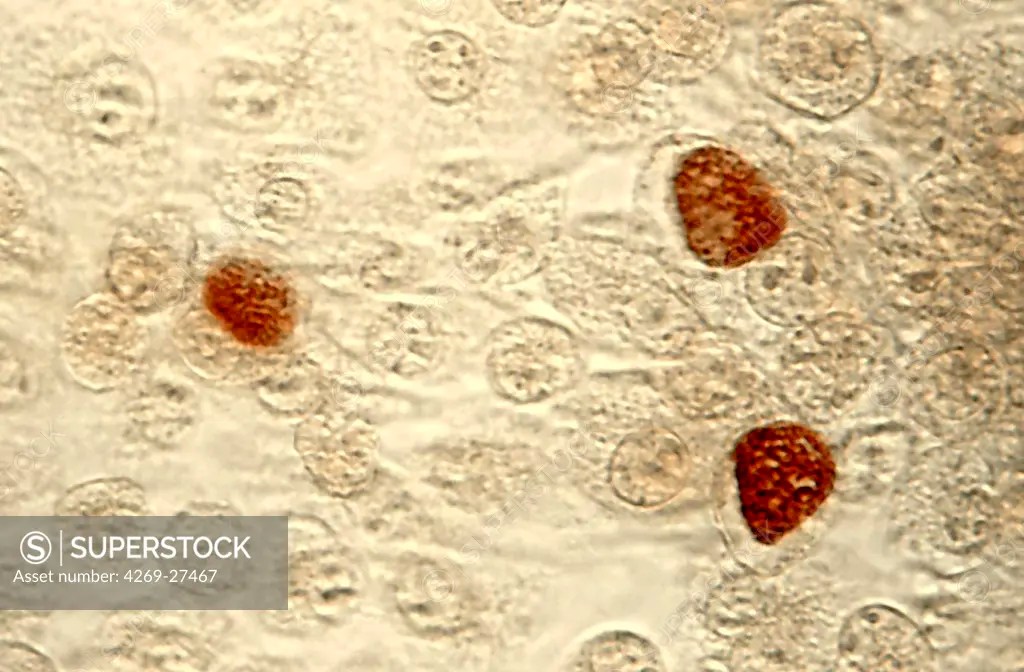 Chlamydia trachomatis. Light micrograph of the parasite bacterium Chlamydia trachomatis