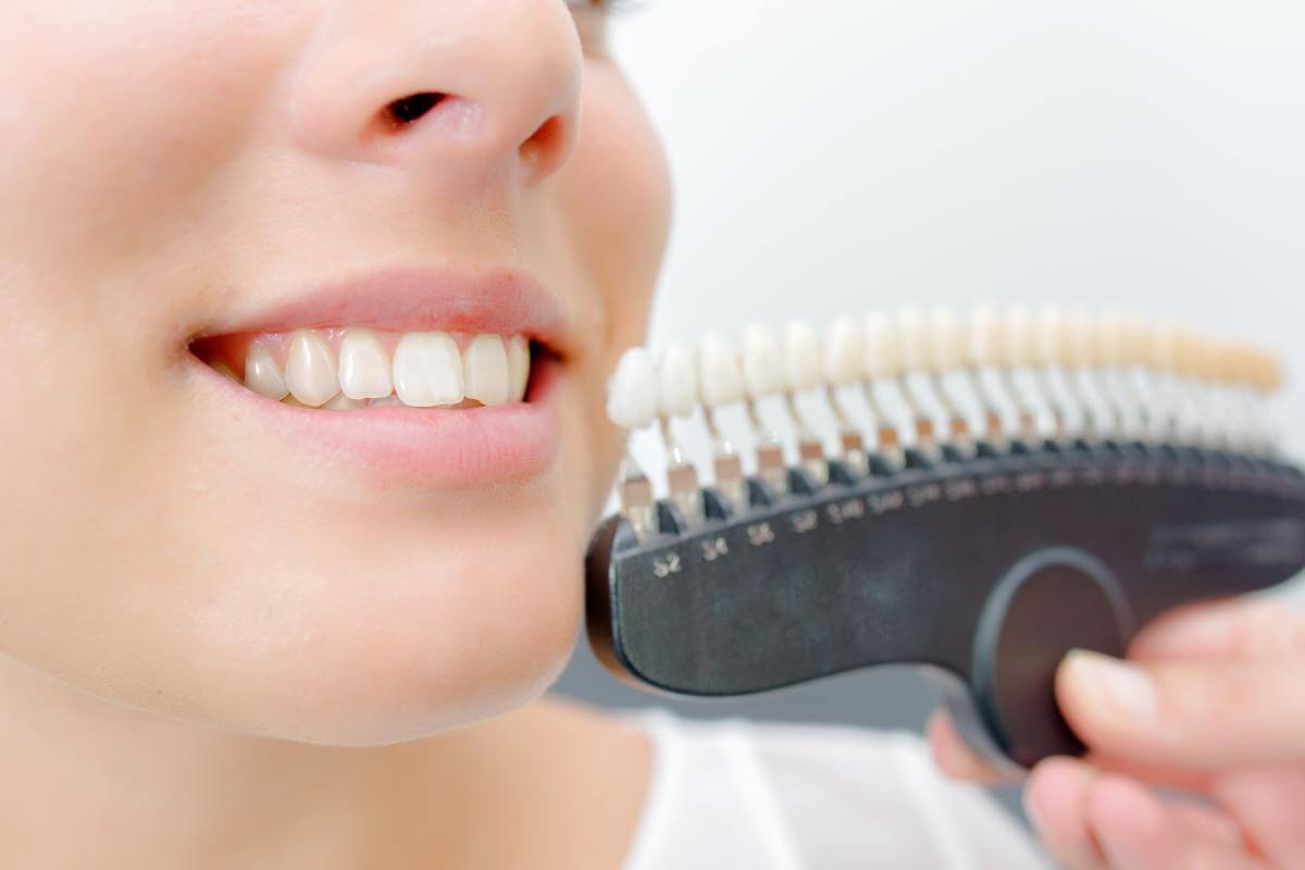 How to Get Rid of Stained Teeth Cosmetic Dentistry in Texas