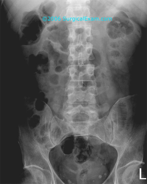 Surgical Exam