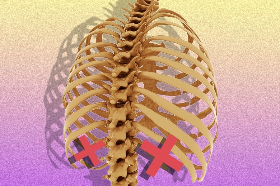 Rib Removal Surgery Cost, Importance and Risks Sutured