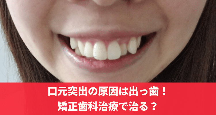 受け口、しゃくれた顎の手術前後 ２０代 | 顎変形症 | 分割手数料0円！名古屋市栄の大山矯正歯科 口元突出の原因は出っ歯！矯正歯科治療で治る？ | 長崎の矯正専門「すずき矯正歯科」