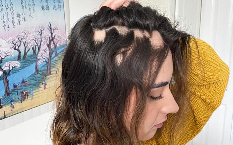 Does Covid Cause Hair Loss How to Guide 2022 Does Covid Cause Hair Loss How to Guide 2022