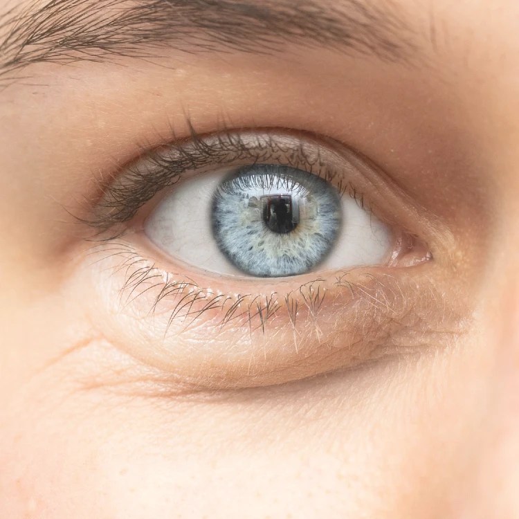 Understand The Connection Between Sleep and Swollen Eyelids