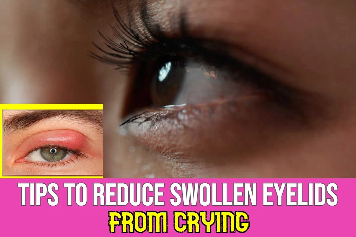 Tips To Reduce Eyelids Swelling or Inflammation From Crying