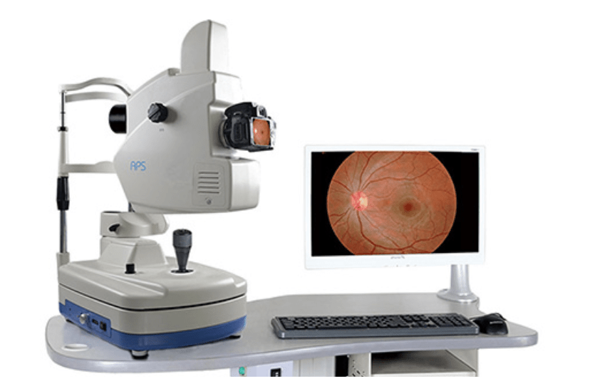 Fundus Fluorescein Angiography Fundus Angiography Eye Synergy Eye Care