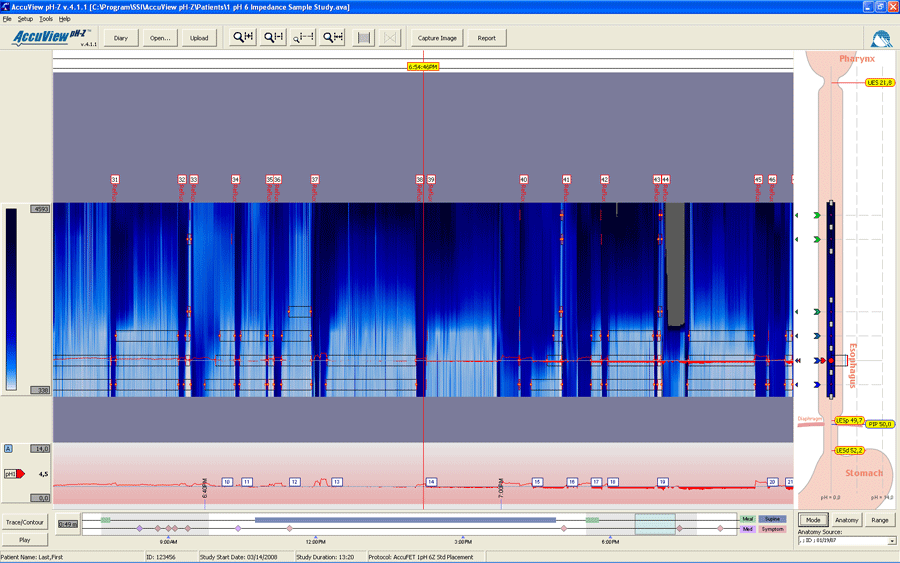 SynMed Medicinteknik AB Digitrapper pH Z