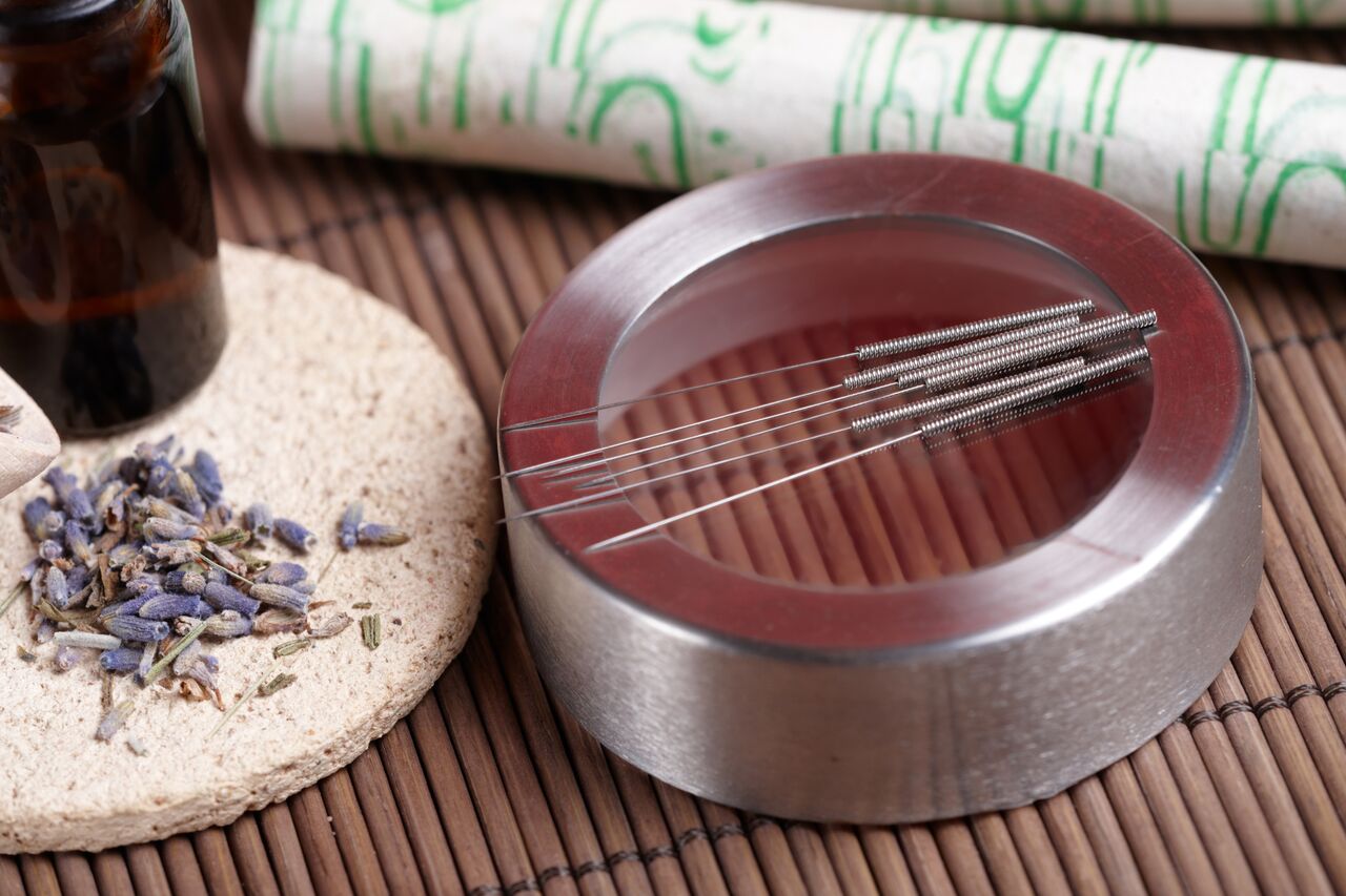 Acupuncture and IVF Talking Fertility