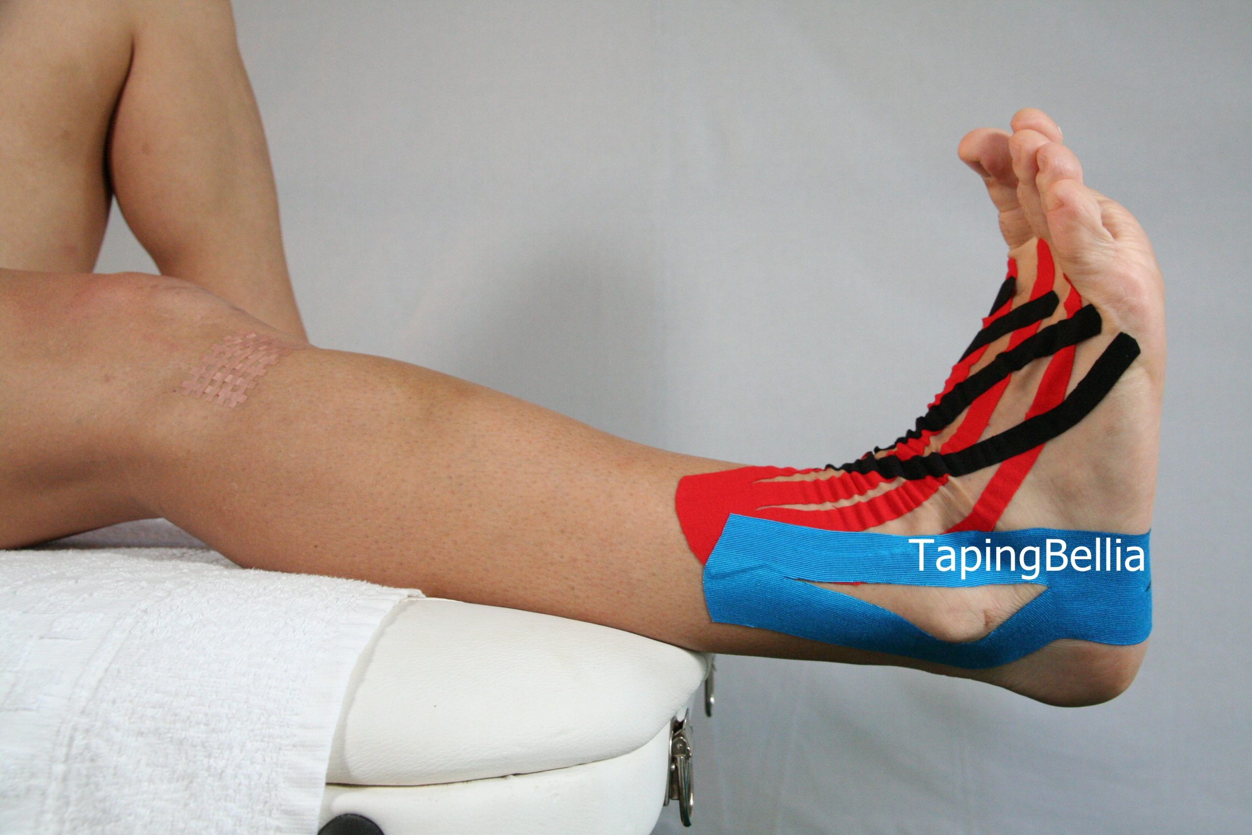 Il Taping kinesiologico Bellia System nella Podologia Bellia Rosario