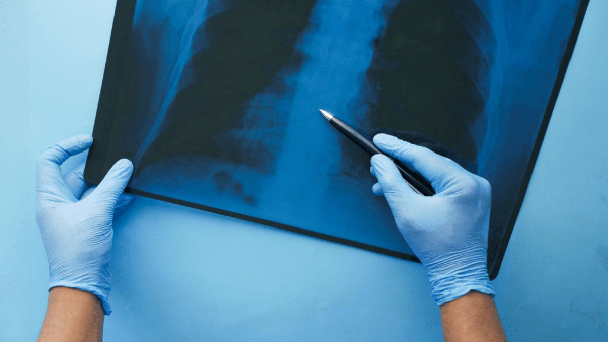 What Is Digital Radiography and How Does It Work? Tapscape