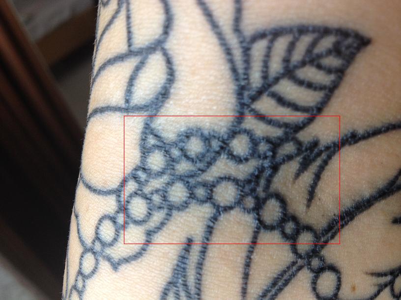 Problemhaut..? TattooBewertung.de