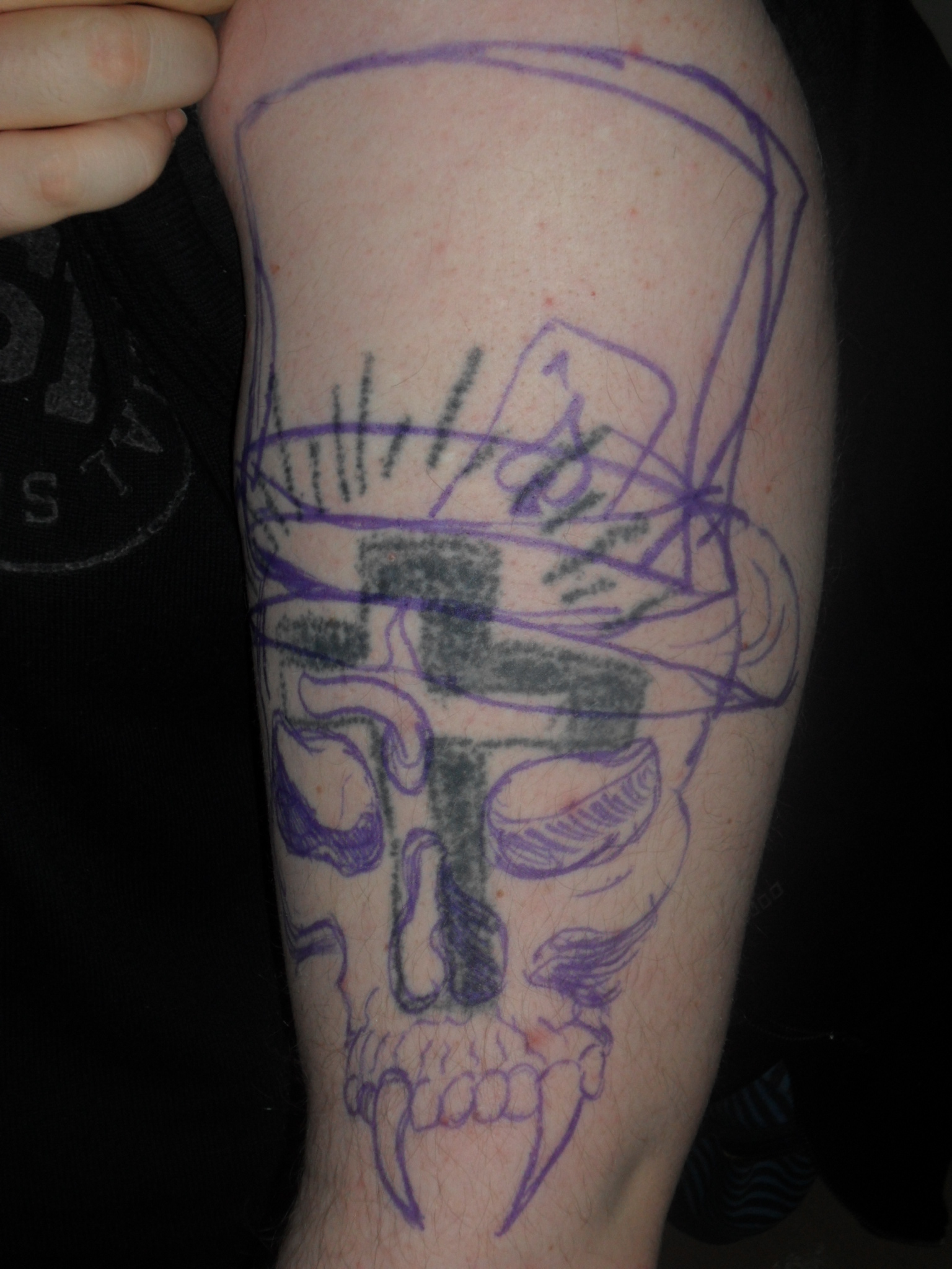 Hilfe Harte Nuss ) TattooBewertung.de