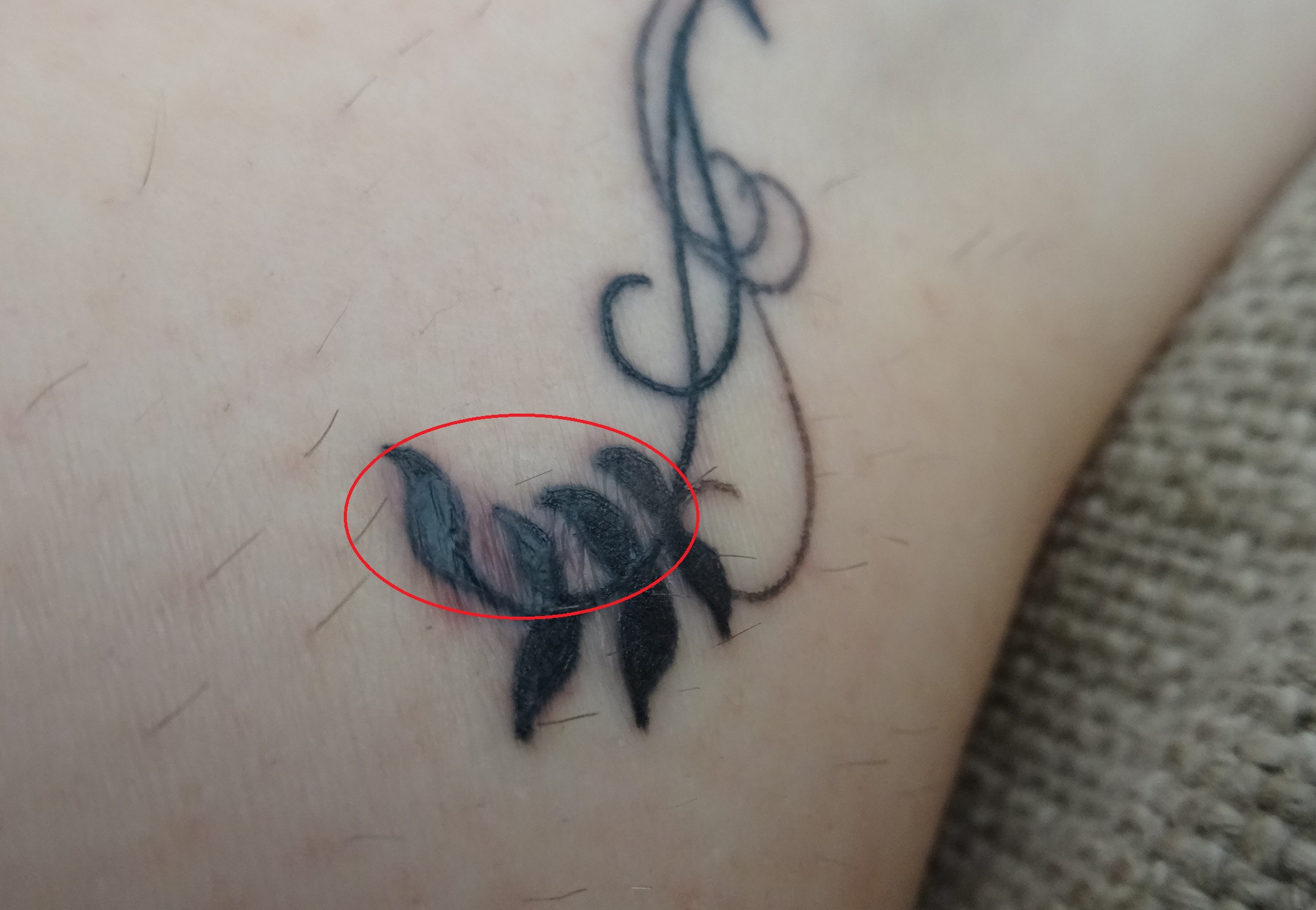 Aftercare - Was Hab Ich Falsch Gemacht? | Tattoo-Bewertung.de 1461_x_2113_jpg