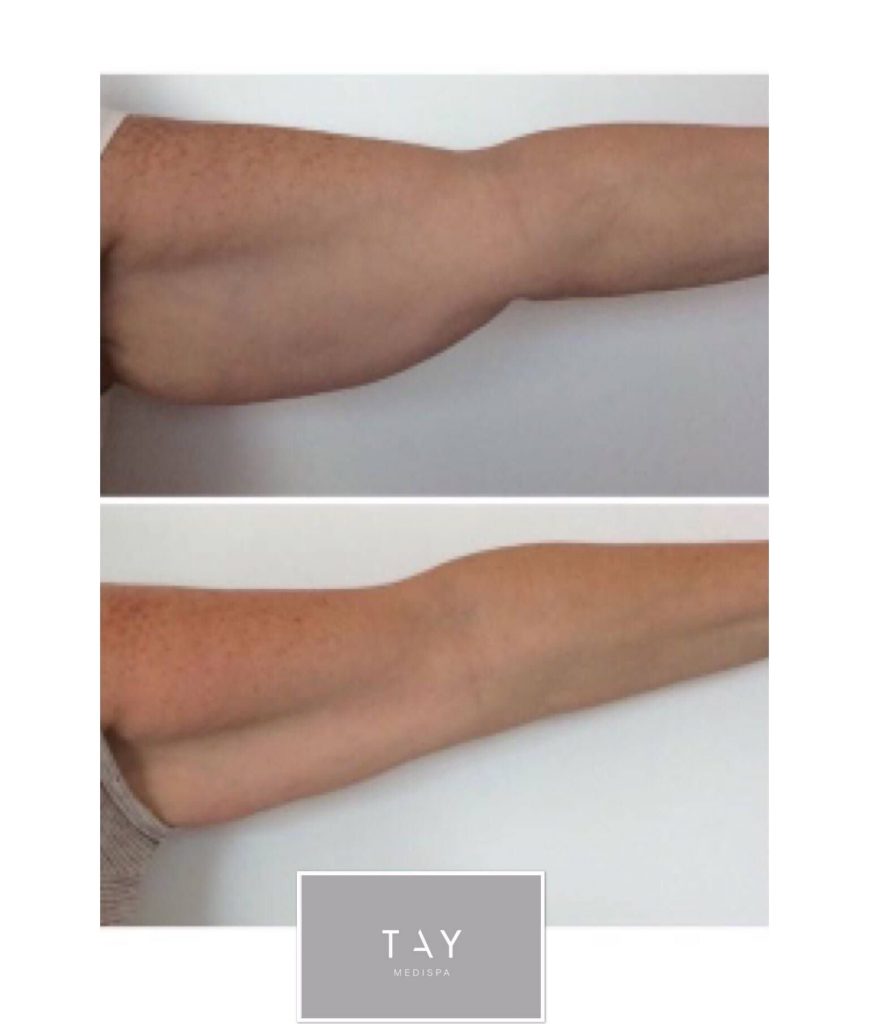 News/Blog Tay Medispa News/Blog Tay Medispa