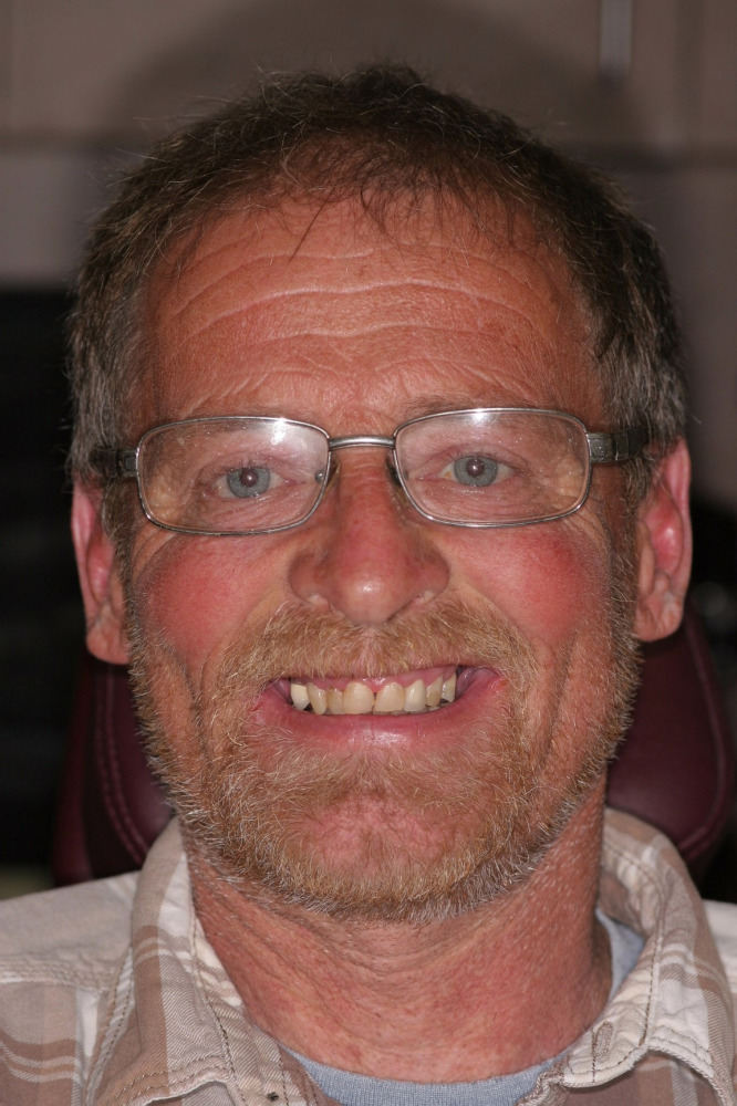 Meet Chuck Total Care Dental Madison, Wisconsin