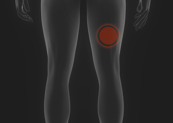 Hamstring Strain T.E.A.M. CLINIC®