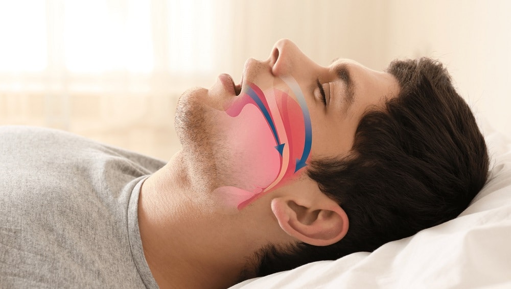 5 Best Sleep Apnea Pillows of 2023 Useful For Your Sleeping Positions