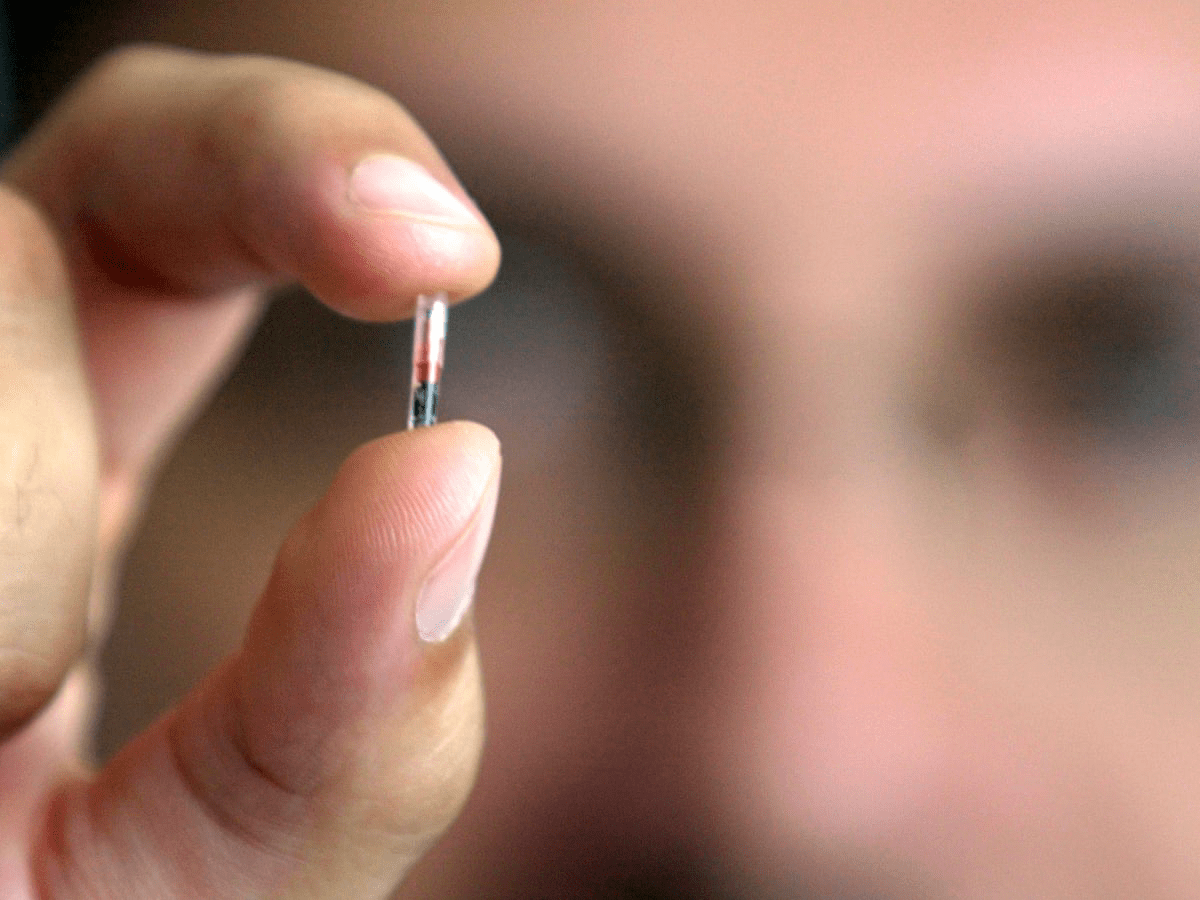 Should Identity Chips Be Implanted Under The Skin?