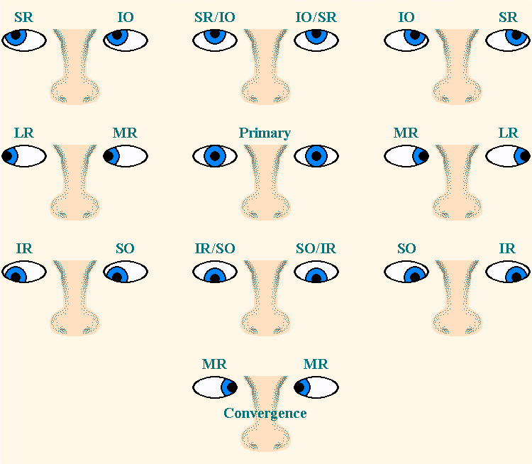 Yoked Extraocular Muscle Movements in Cardinal Positions of Gaze