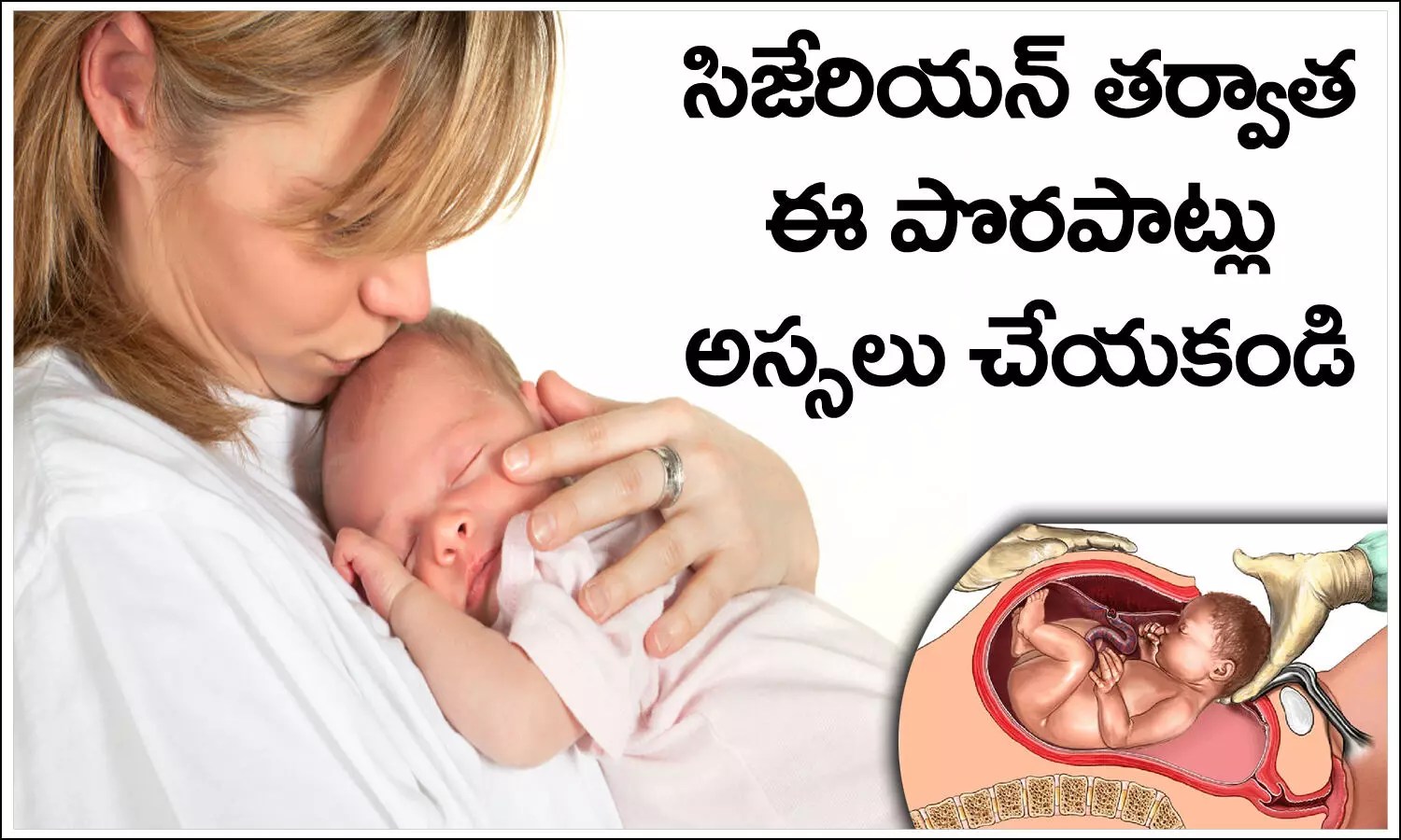 సిజేరియన్ డెలివరీ తర్వాత ఈ పొరపాట్లు అస్సలు చేయకండి CSection Tips