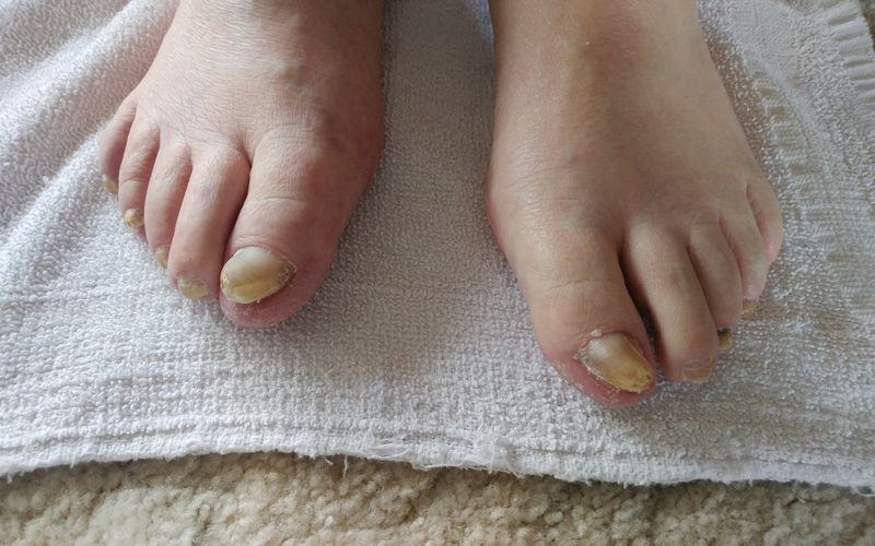 Medical Pedicures Pedicures Boise, Idaho 208853TOES