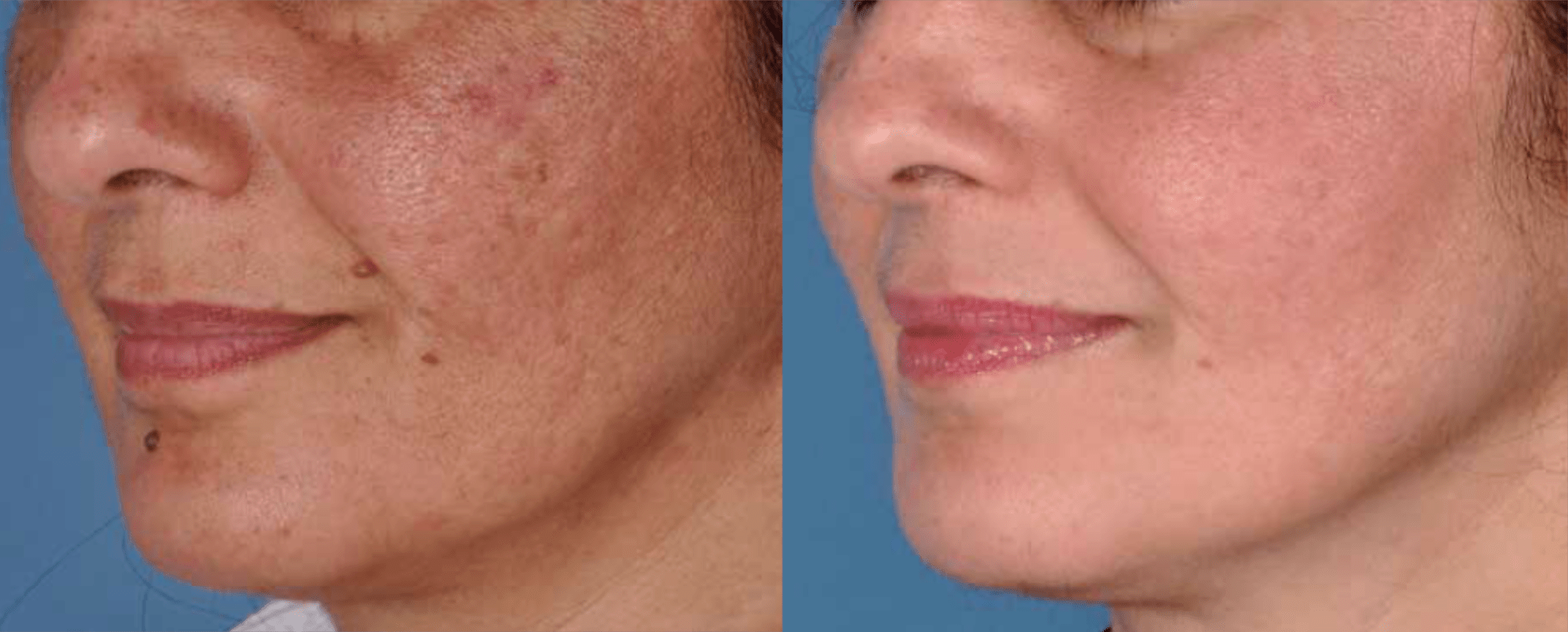 ZO Skin Health Browse & Reorder ZO Products Thames Skin Clinic
