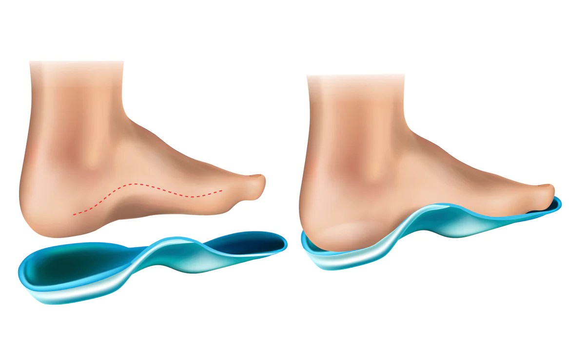 How to Choose the right shoes for high arch high instep?