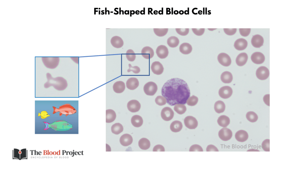 FishShaped Red Blood Cells • The Blood Project