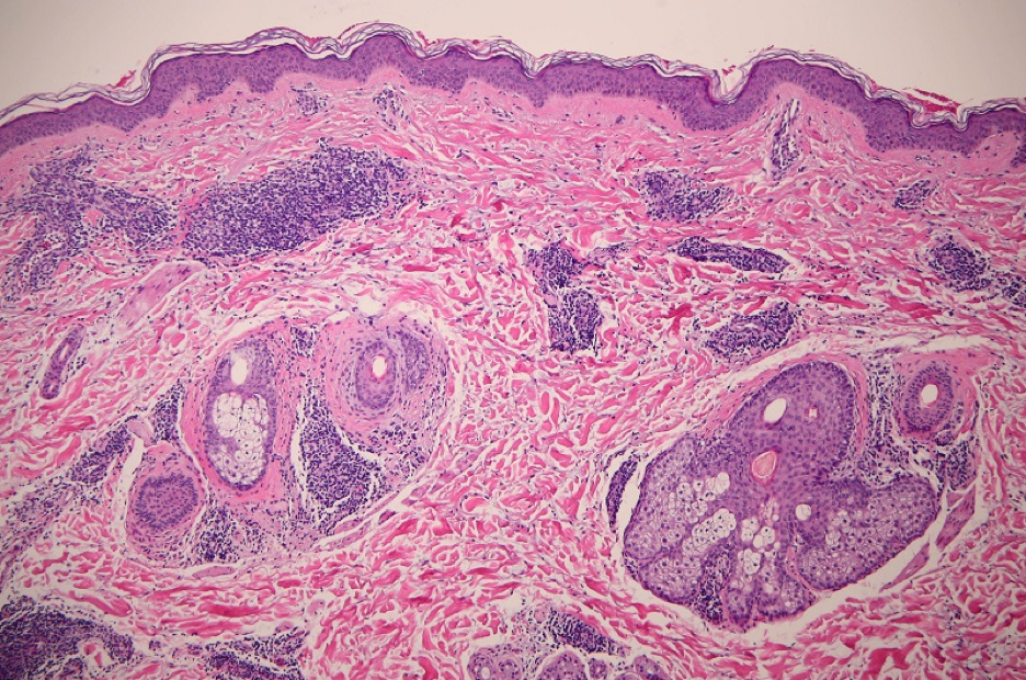 37YearOld Female with Pruritic Rash on Upper Body The Doctor's Channel