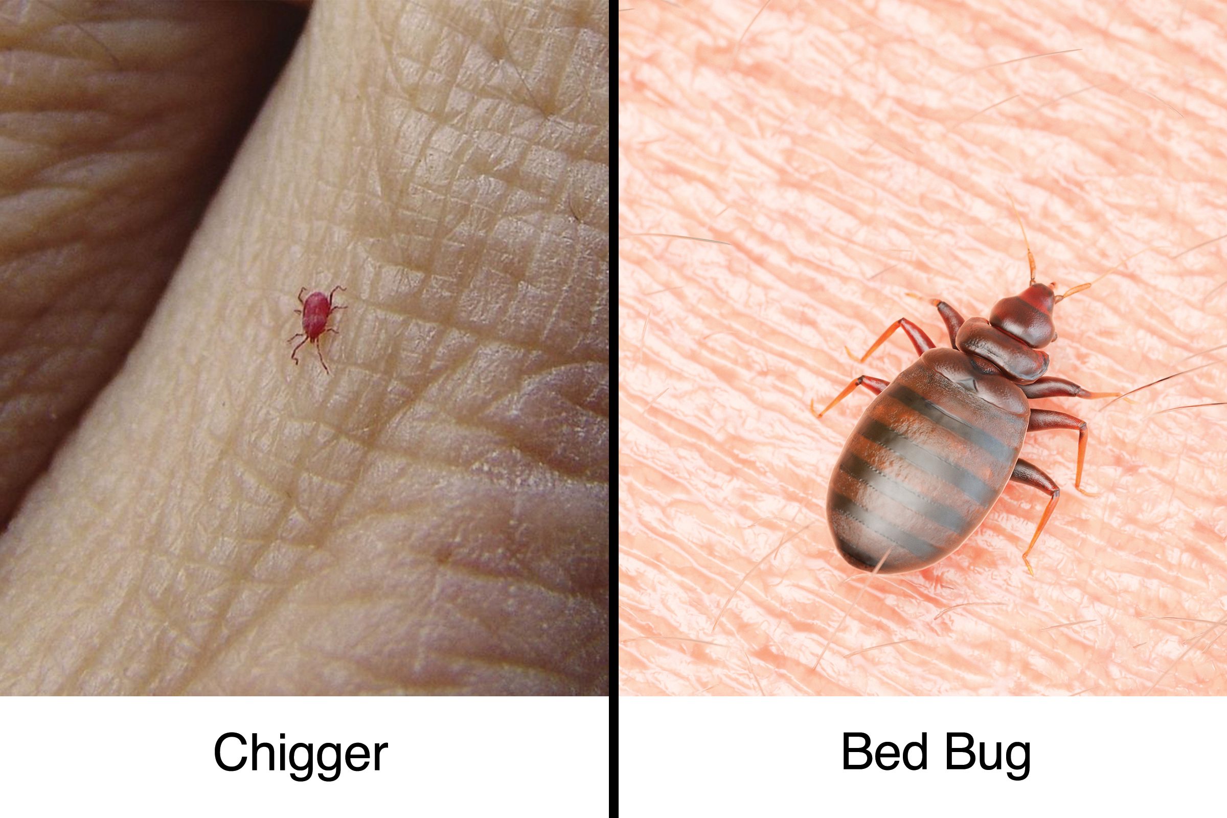 Chigger Bites vs. Bed Bug Bites How to tell the Difference The Healthy