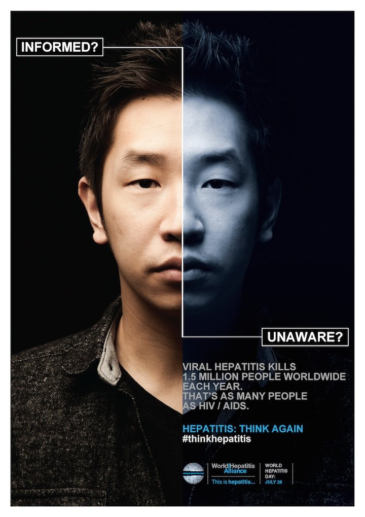 World Hepatitis Day July 28th Think Again