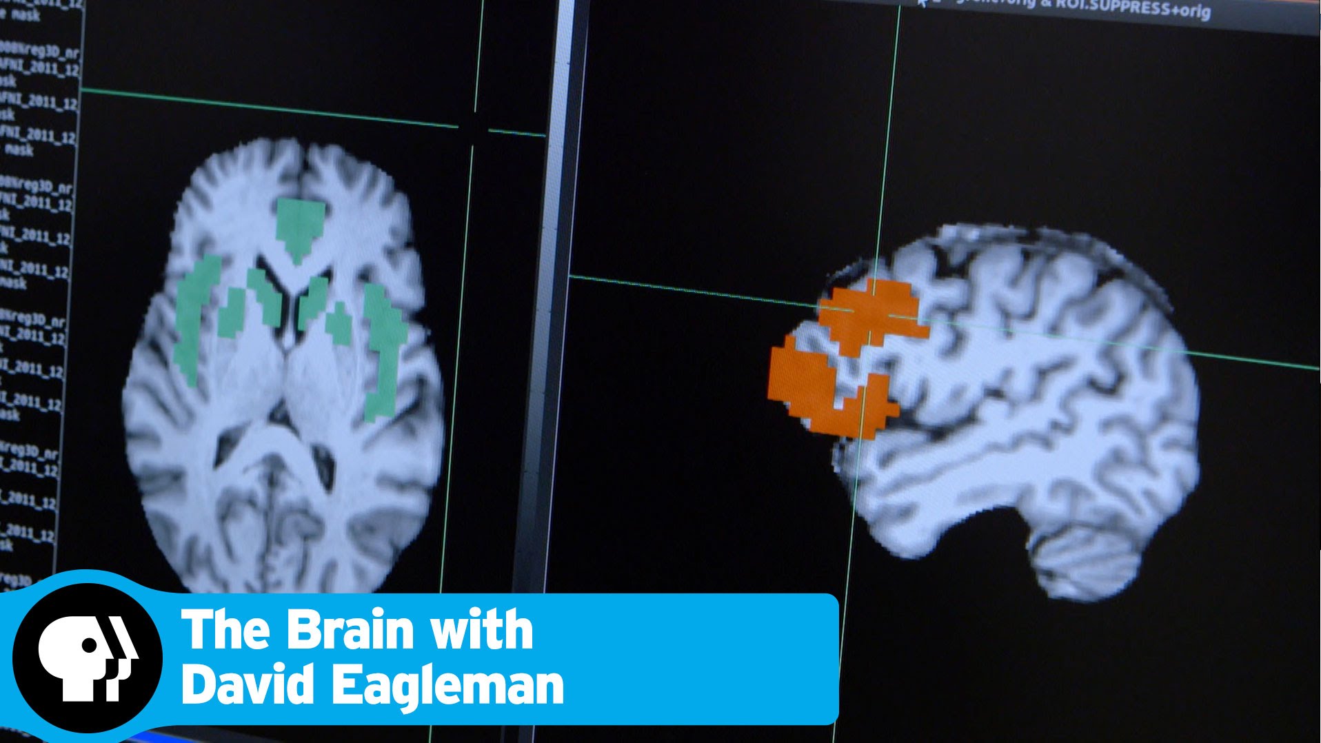 David Eagleman The brain Addiction The Mind Voyager