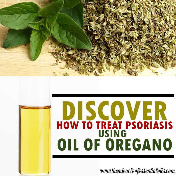 Oil of Oregano for Psoriasis Treatment How it Works & Recipes The