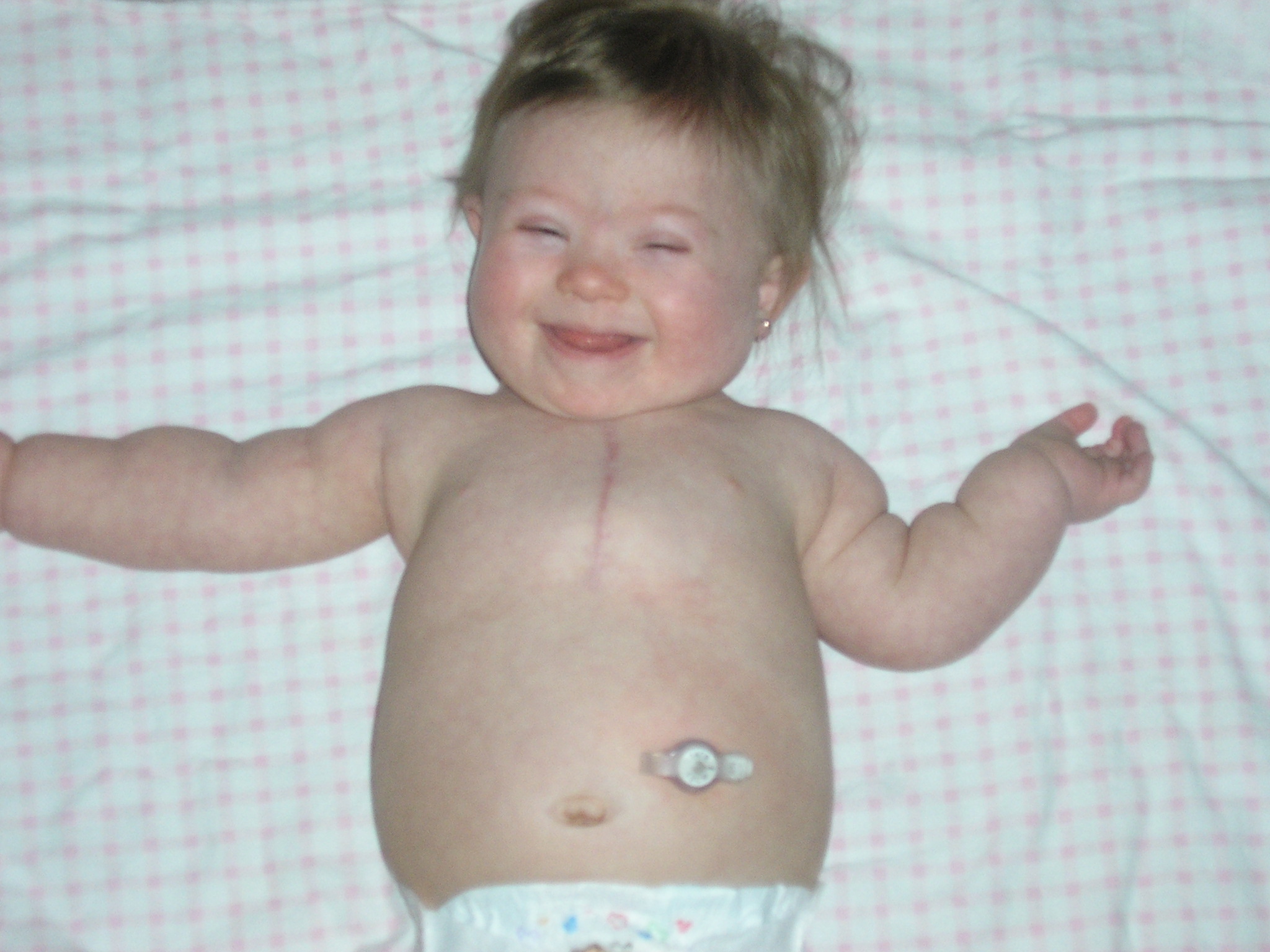 The Mom Crowd » Tube Feeding Your Child