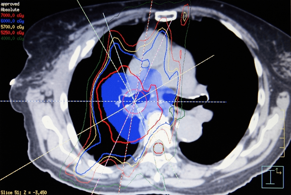 Field Cancerization The Moss Report