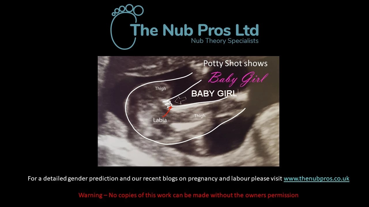 Home The Nub Pros Ltd