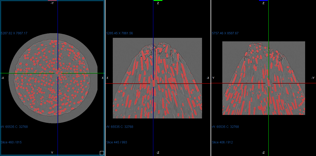 Intensity Ranges and Threshold Segmentations
