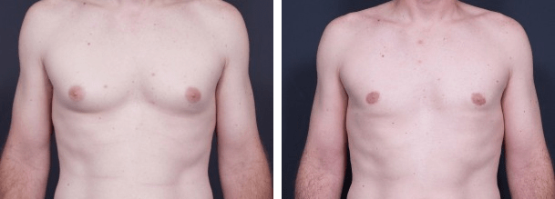 Restoring SelfConfidence in Males Afflicted with The