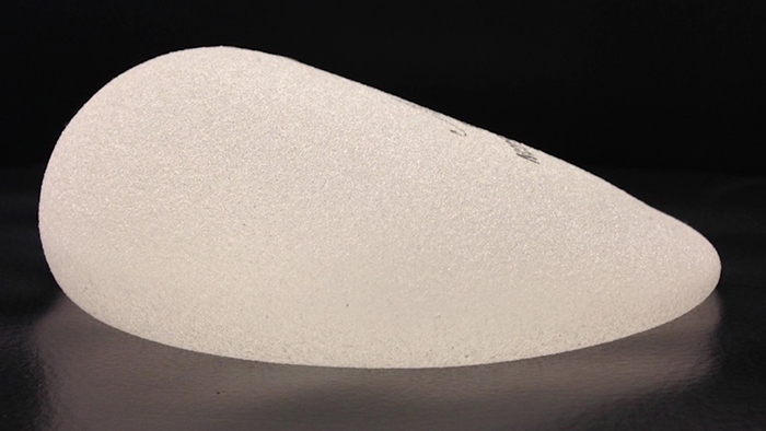 MacroTextured Implants and Breast ImplantAssociated ALCL The