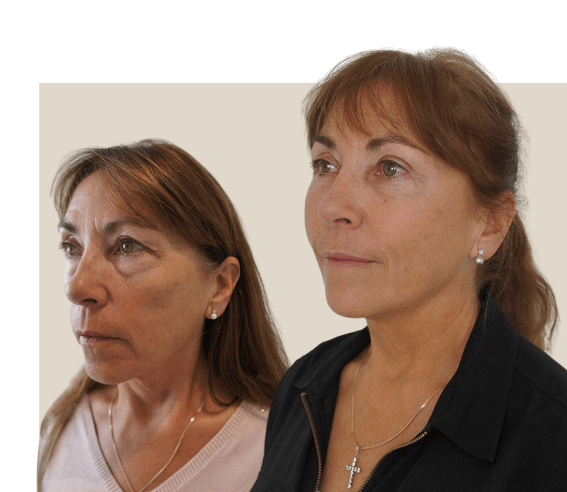 The Plastic Surgery Clinic Sydney & Central Coast Dr Reddy