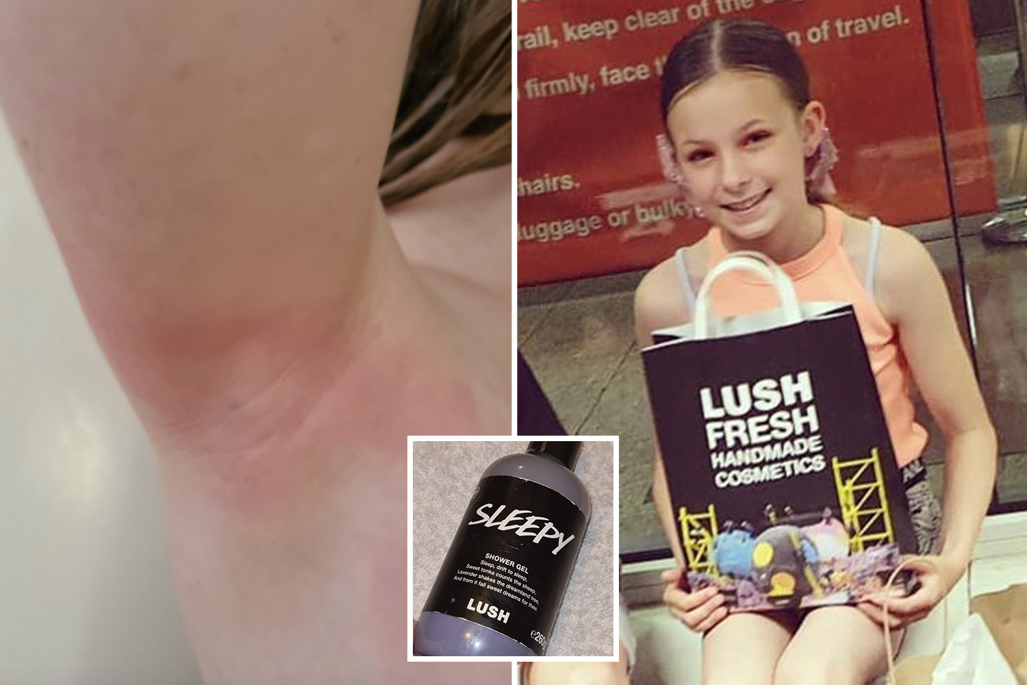 My daughter, 7, broke out in red itchy rash after 'reaction to Lush