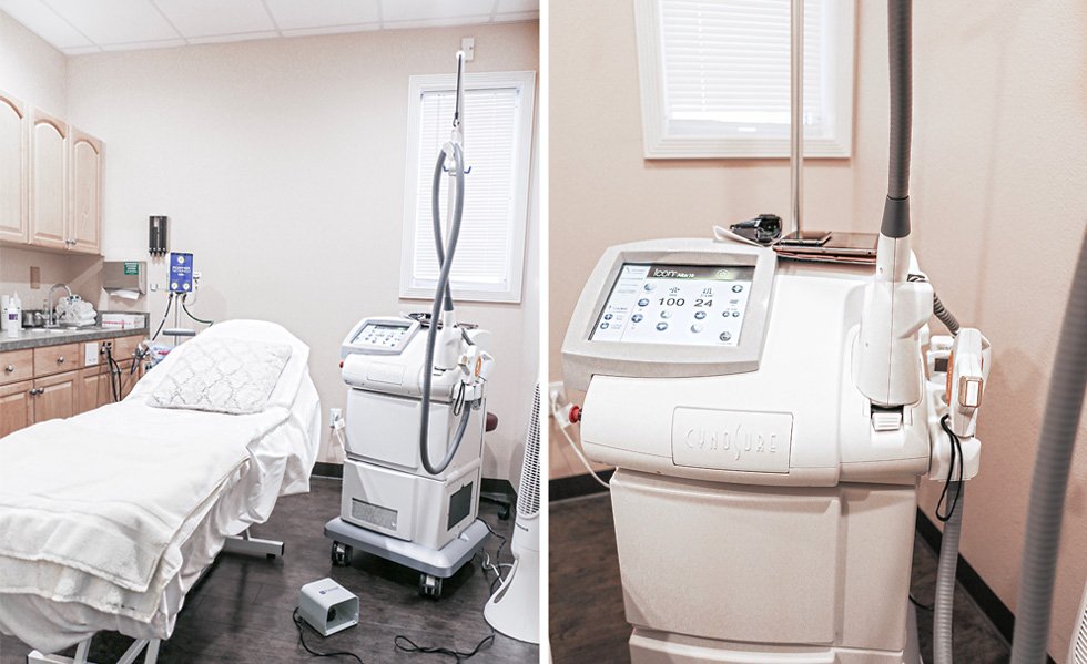 Laser Hair Removal Review Sarasota