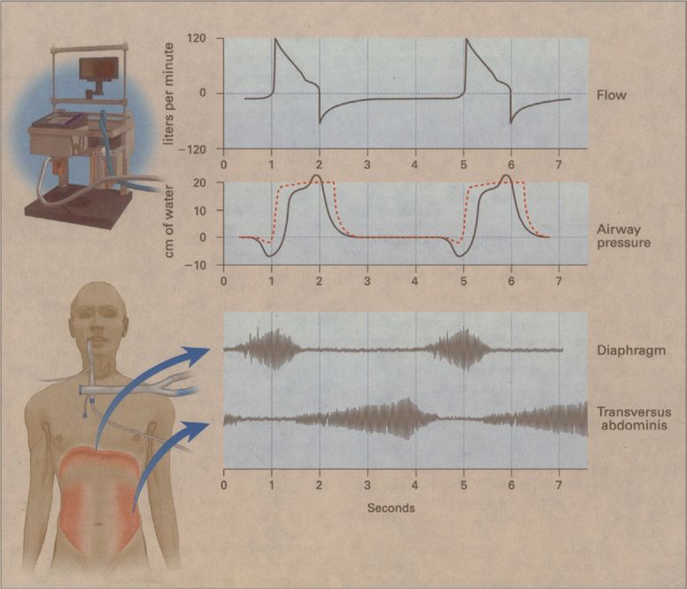 Principles of Mechanical Ventilation Thoracic Key