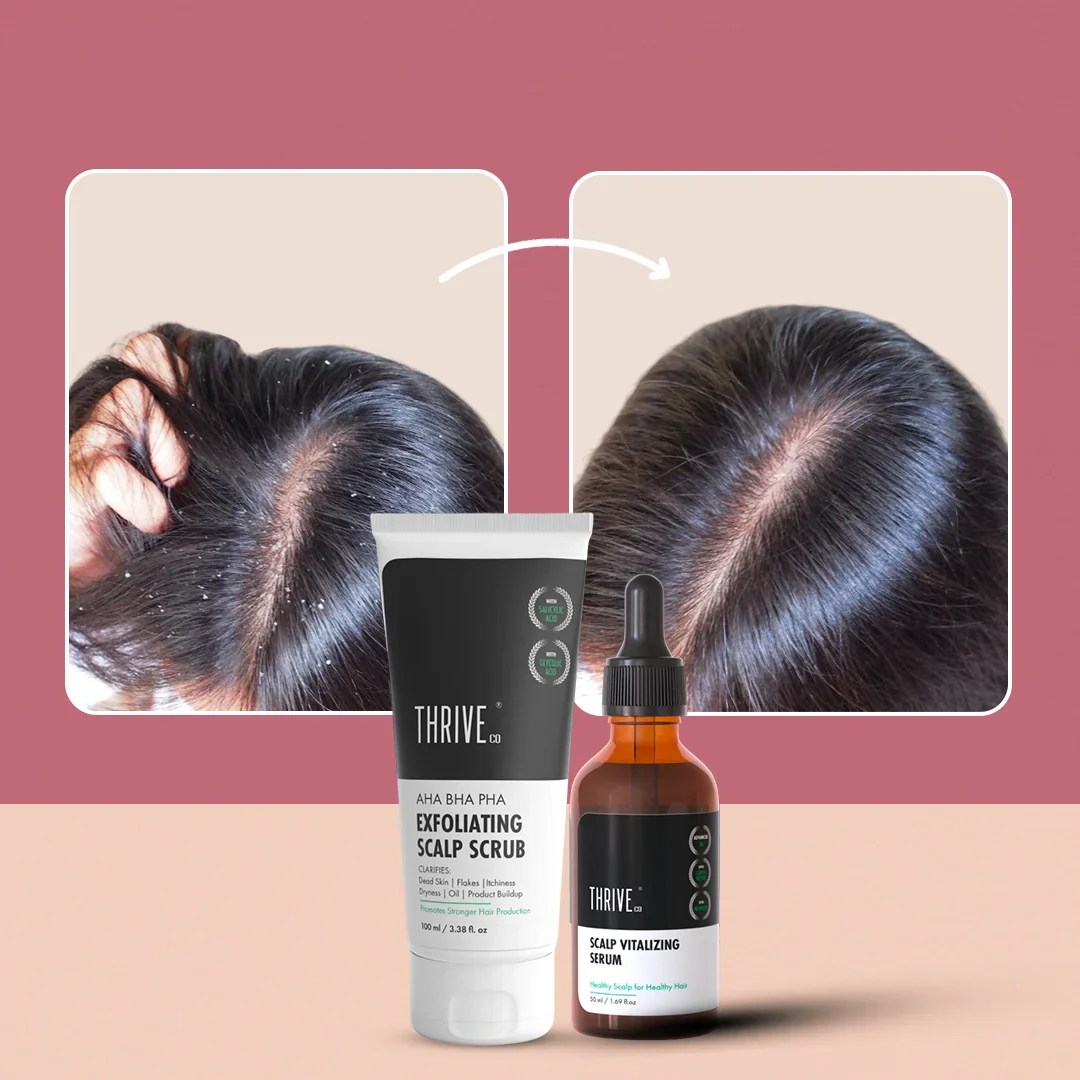 Scalp Care Kit for Itchy & Dry Scalp Treatment ThriveCo