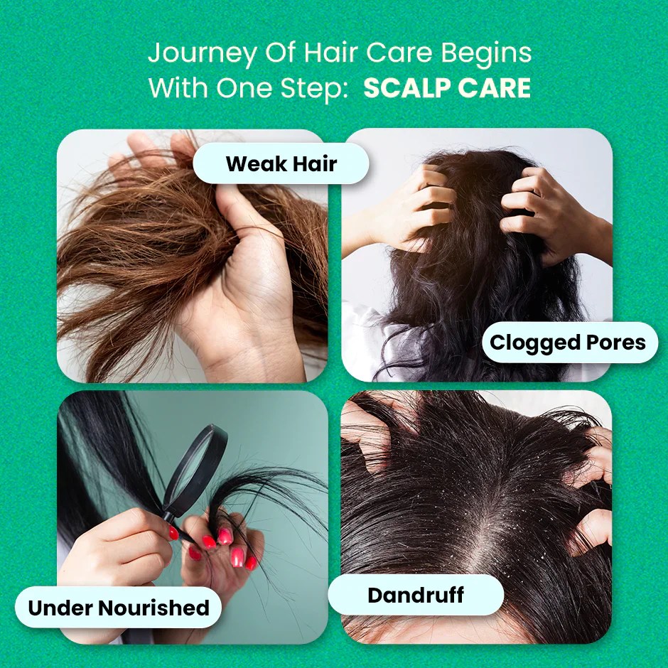 Scalp Care Kit for Itchy & Dry Scalp Treatment ThriveCo
