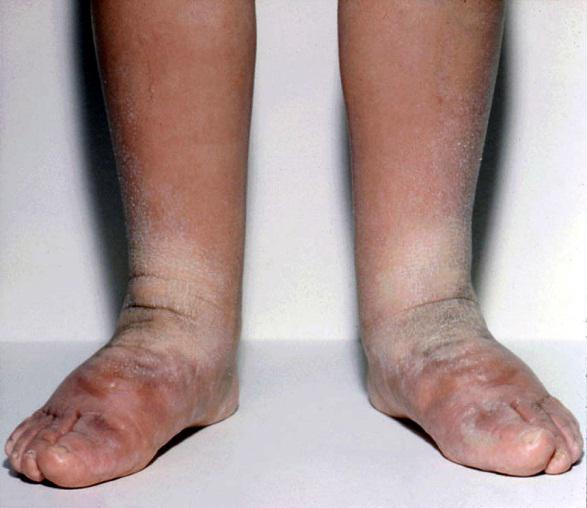 figure9 Thyroid Disease ManagerThyroid Disease Manager