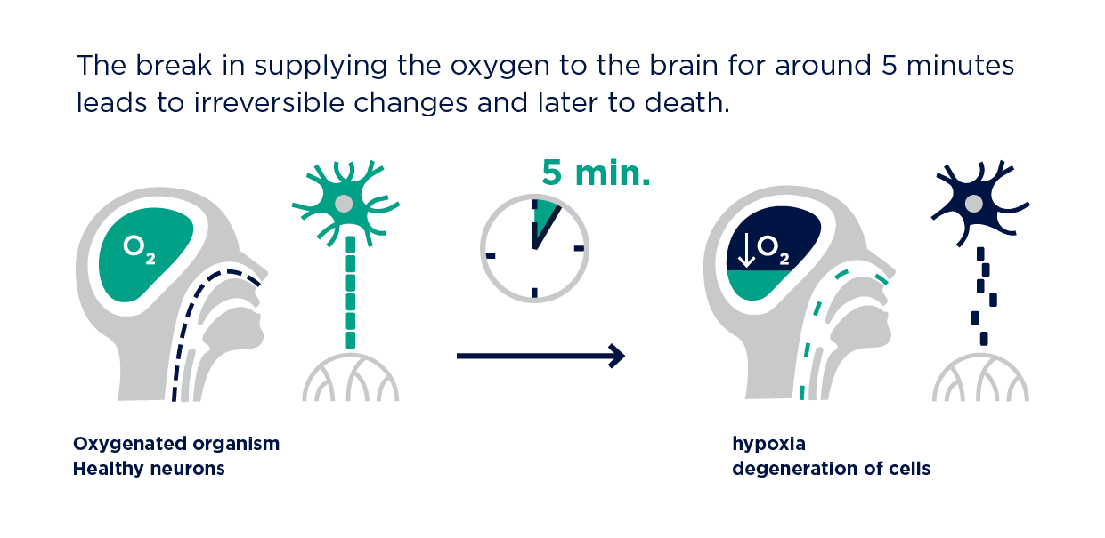 Oxygen therapy everything what you should know Timago International