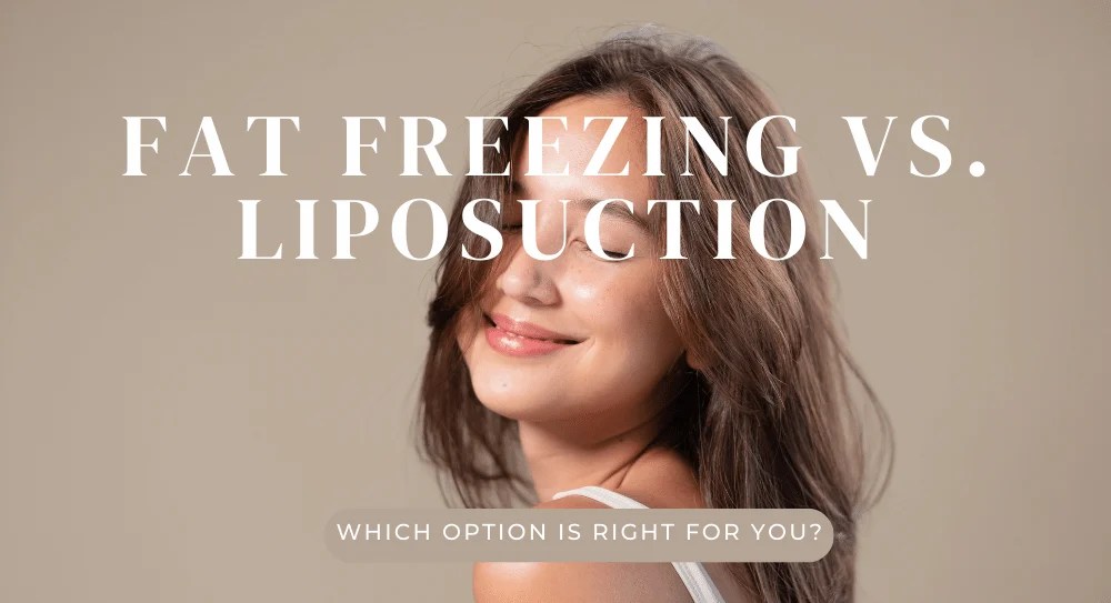 Fat Freezing vs. Liposuction Which Option is Right for You?