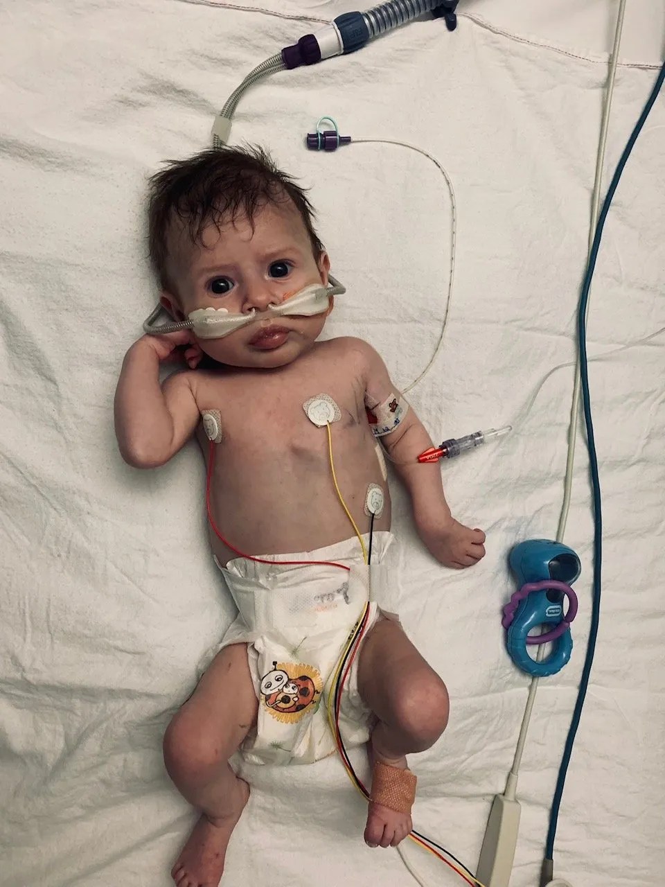 CoarctationoftheAortaVSDASDPippasStory4 Tiny Tickers