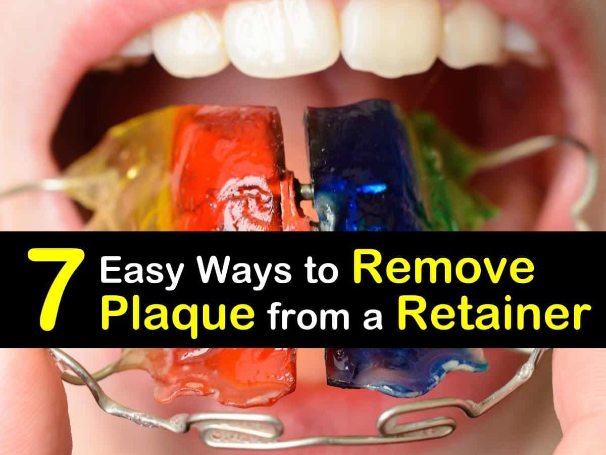 How To Remove Plaque From Plastic Retainers All
